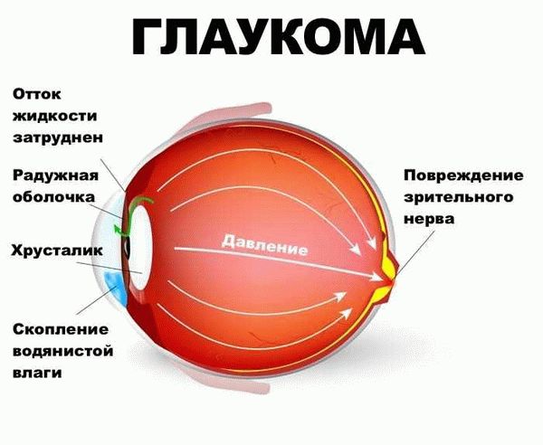 Критерии утверждения группы инвалидности